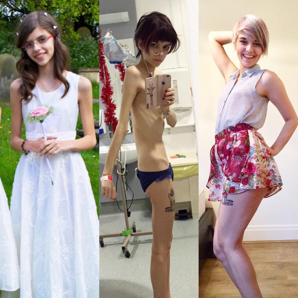 These Women Have Told the World Why They’re Grateful for Every Pound They Put On