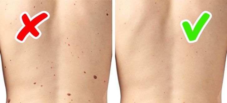 6 Signs Of Serious Diseases Signaled By Our Skin