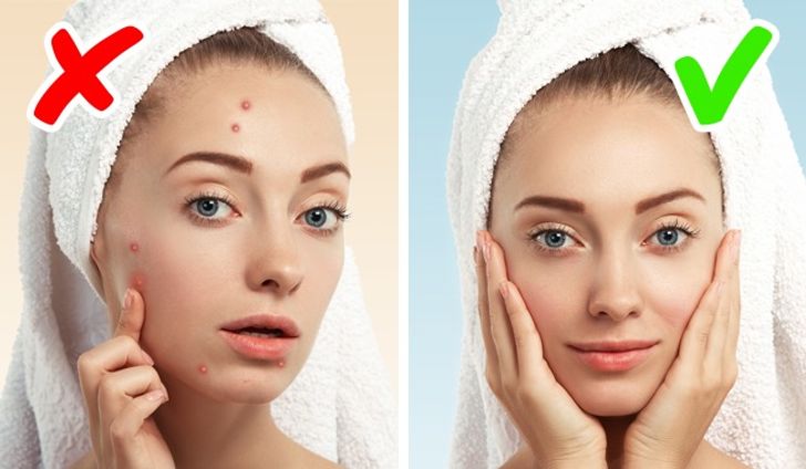 6 Signs Of Serious Diseases Signaled By Our Skin – HealthW