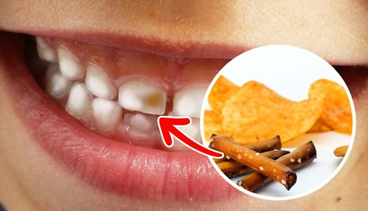 The Top 7 Foods That Severely Harm Your Teeth
