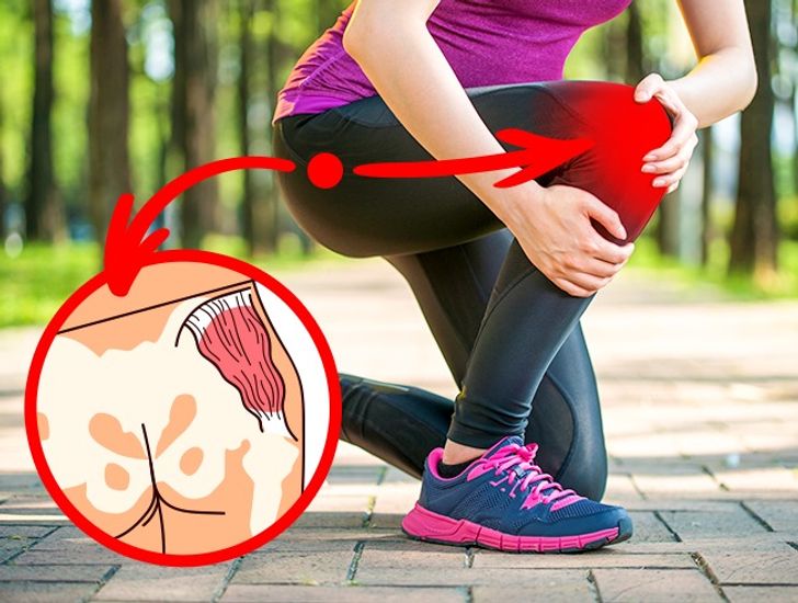 This Little-Known Condition Endangers All Office Workers’ Health