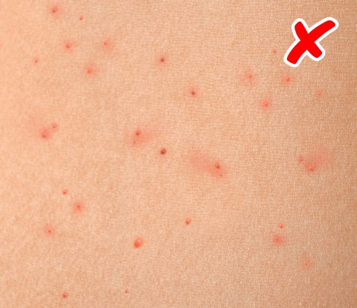 6 Signs Of Serious Diseases Signaled By Our Skin