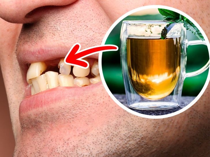 The Top 7 Foods That Severely Harm Your Teeth