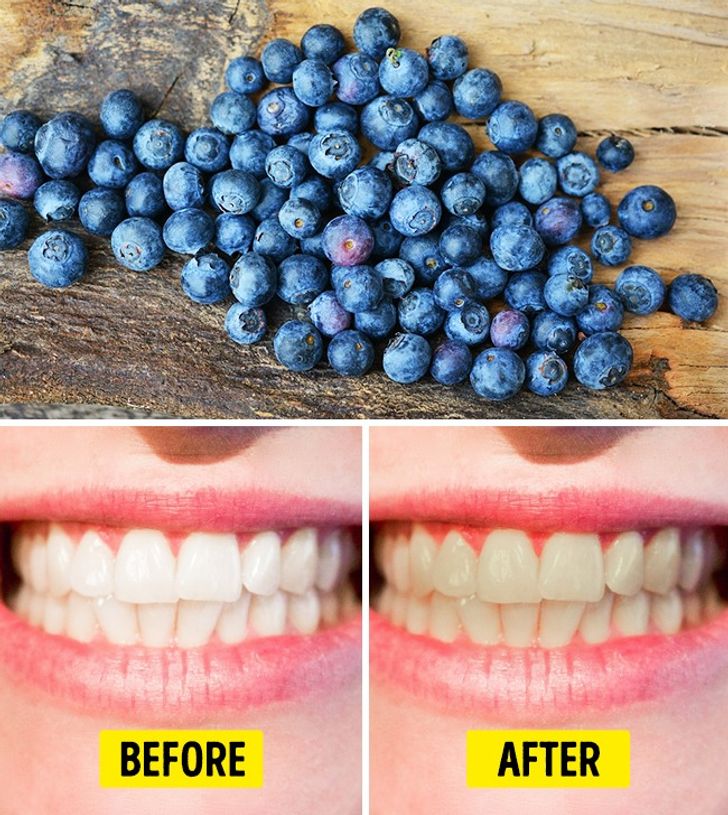 The Top 7 Foods That Severely Harm Your Teeth