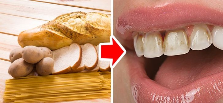 The Top 7 Foods That Severely Harm Your Teeth