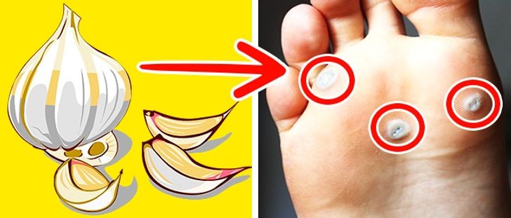6 Homemade Medications Which Are Proven to Stay Effective for Years