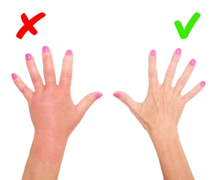 6 Signs Of Serious Diseases Signaled By Our Skin