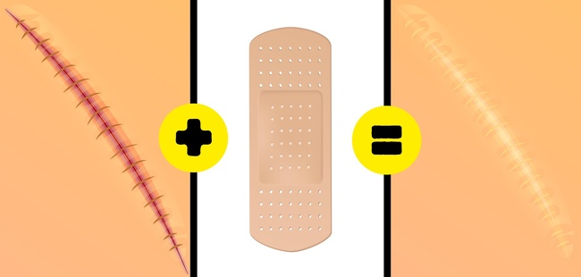 7 Hacks to Remove All Types of Scars and Help Them Heal