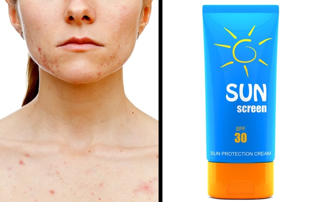 7 Hacks to Remove All Types of Scars and Help Them Heal