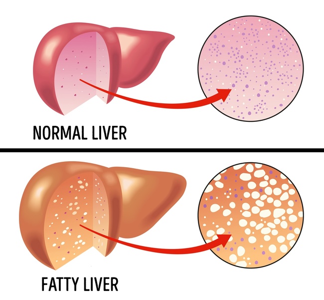 6 Signs You Might Have a Protein Deficiency