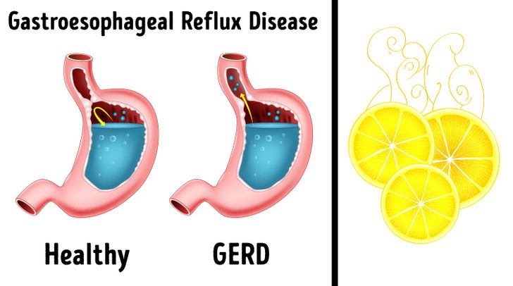 5 Health Conditions Your Breath Can Reveal to You