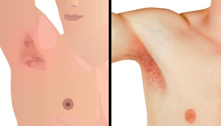 6 Gross Things That Will Happen to You If You Stop Showering