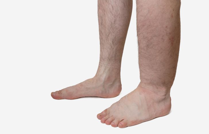 6 Warning Signs of a Blood Clot That Can’t Be Ignored