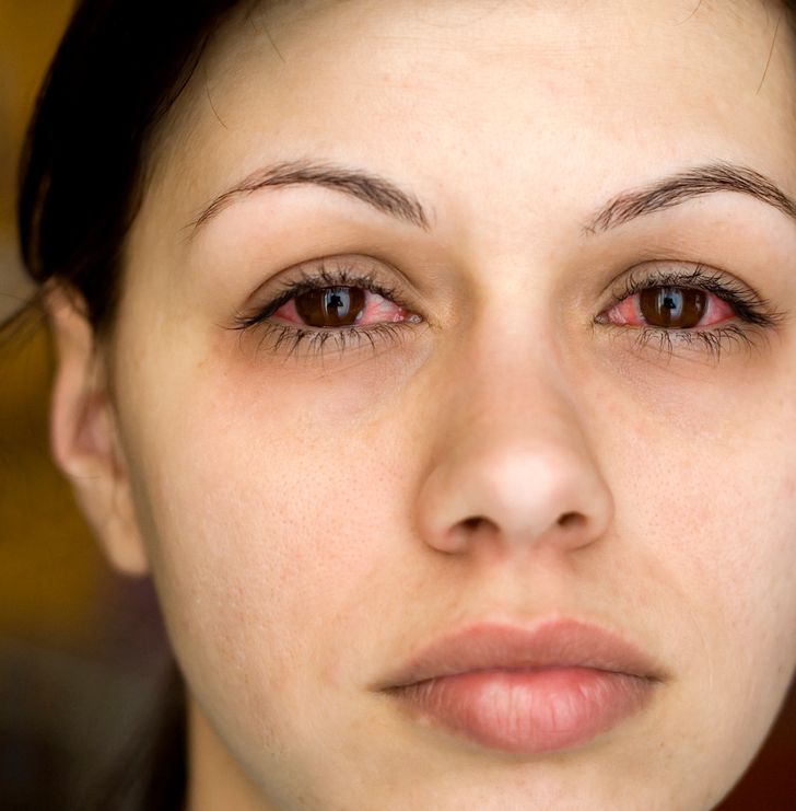 16 Natural Ways to Eliminate Common Infections