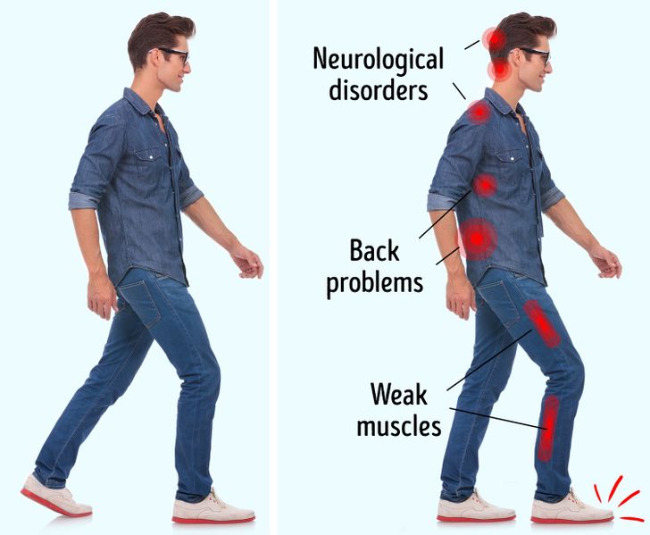 6 Walking Quirks That Reveal Problems With Our Health