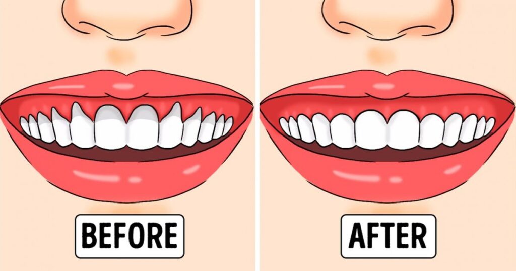 If You Have Receding Or Unhealthy Gums, Here Are Proven Solutions – HealthW