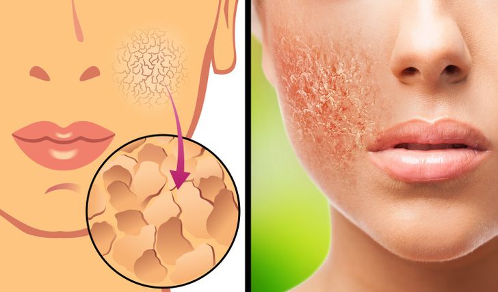 6 Gross Things That Will Happen to You If You Stop Showering