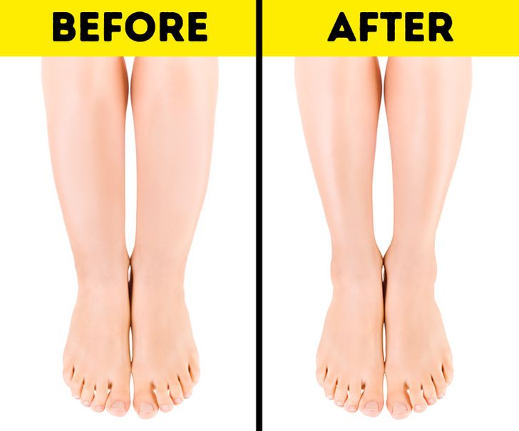 Why You Have Cankles and 5 Tips to Help You Deal Fix Them