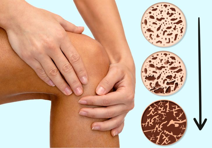 6 Warning Signs of Premenopause You Might Not Be Aware Of