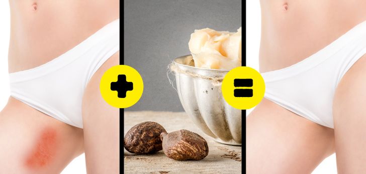 6 Effective Ways to Prevent a Rash on the Inner Thighs