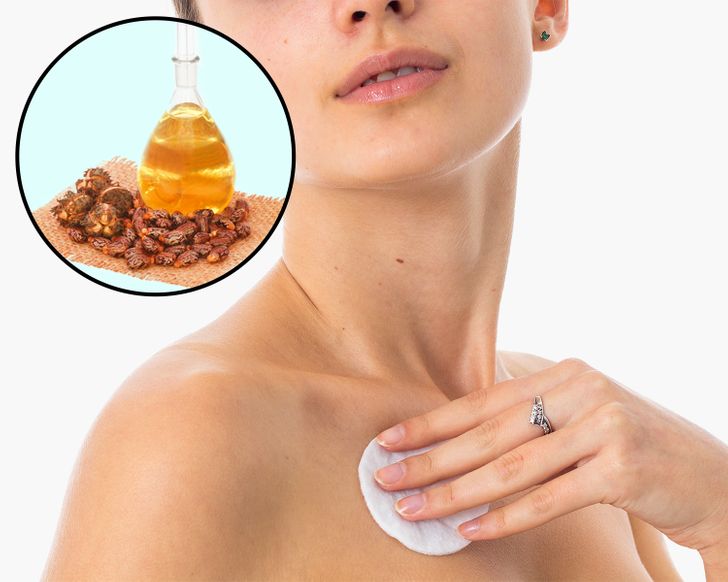 How to Remove Annoying Papillomas and Warts Once For All
