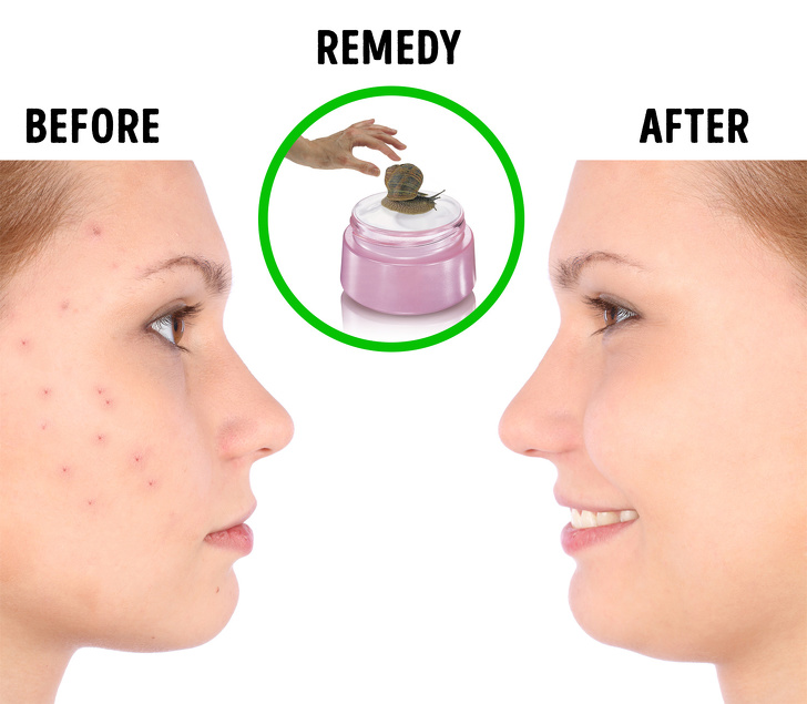 8 Korean Women Skincare Rules That Help Look Much Younger
