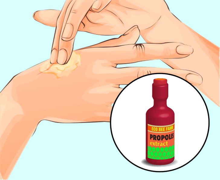 How to Remove Annoying Papillomas and Warts Once For All