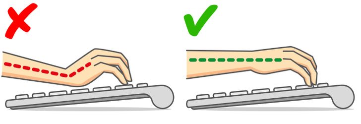 Why Your Hands Can Go Numb at Night and How to Prevent It