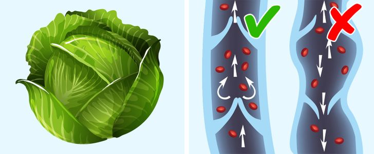 5 Natural Ways to Fight Spider and Varicose Veins