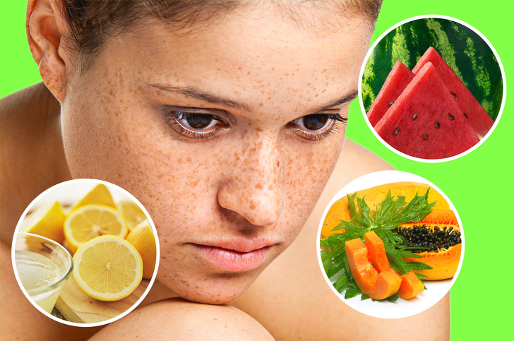 10 Tips to Get Rid of Sunspots With Natural Remedies