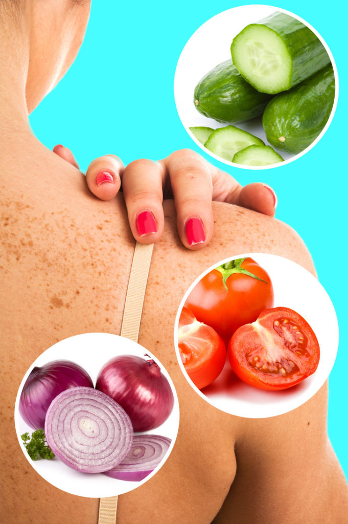 10 Tips to Get Rid of Sunspots With Natural Remedies