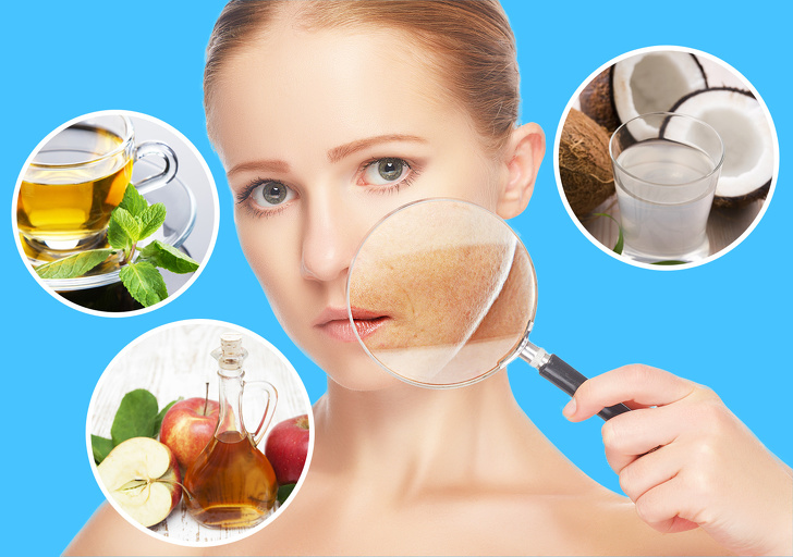 10 Tips to Get Rid of Sunspots With Natural Remedies
