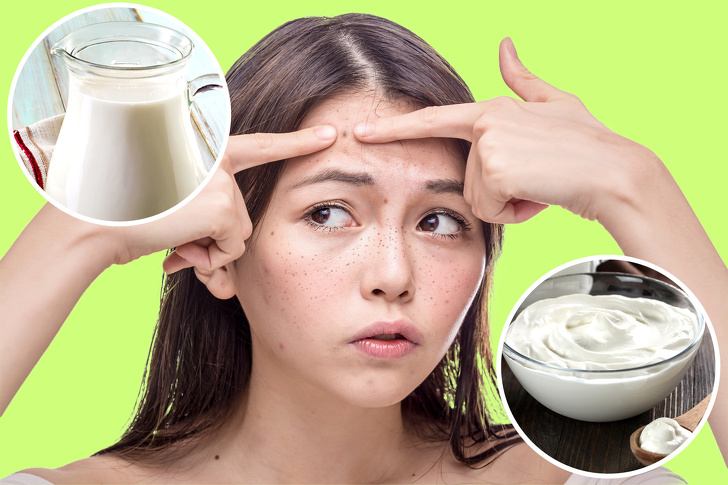 10 Tips to Get Rid of Sunspots With Natural Remedies