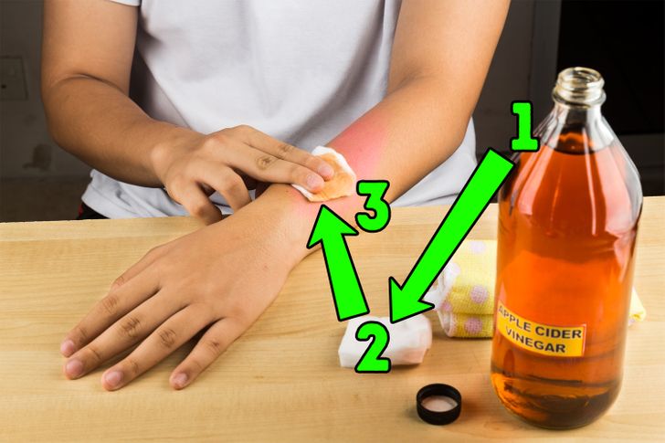 How to Remove Annoying Papillomas and Warts Once For All