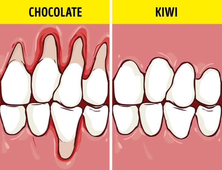 What Foods We Need to Eat to Keep Our Teeth Healthy and White