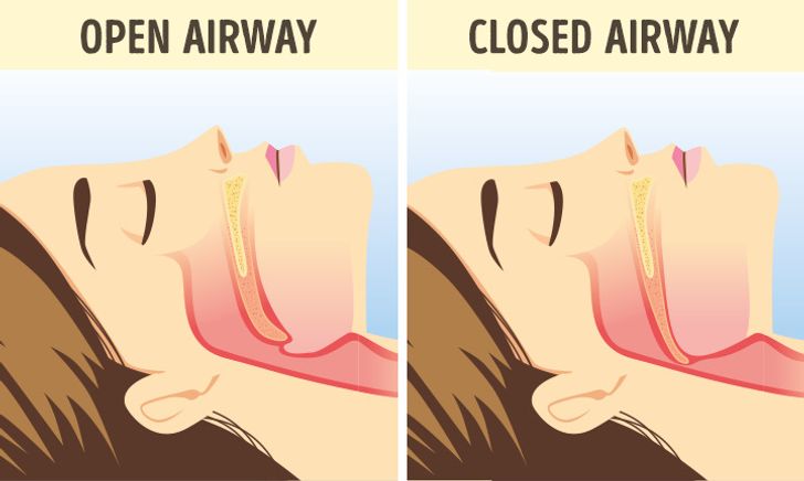 If You Can’t Stop Snoring, Natural Remedies Just Might Help You (and Your Partner)