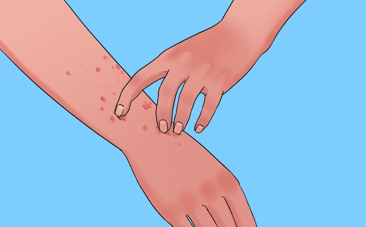 8 Signs That You’re Intolerant to One of the Most Common Foods