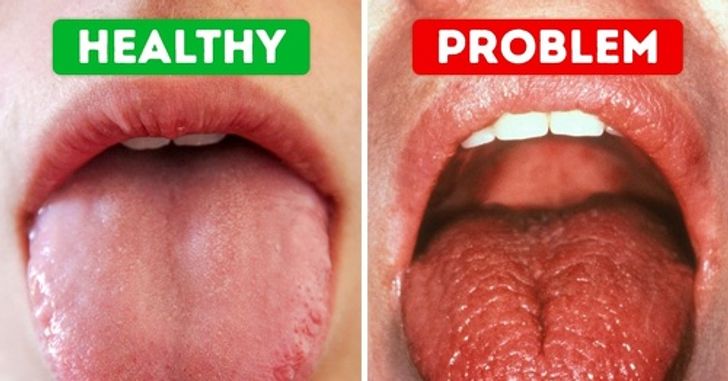 If You Suffer From a Dry Mouth, Here Are 7 Ways to Help You