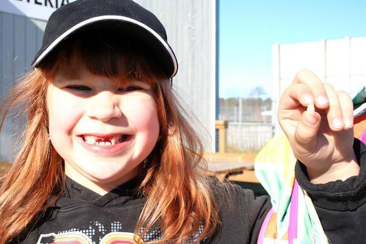 Check Why Doctors Are Urging Parents To Keep Their Kid’s Baby Teeth