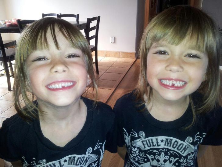 Check Why Doctors Are Urging Parents To Keep Their Kid’s Baby Teeth