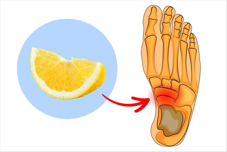 What to Do If Your Heel Hurts in the Morning or Every Time You Stand Up