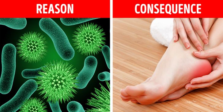What to Do If Your Heel Hurts in the Morning or Every Time You Stand Up