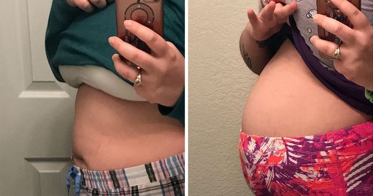 5 Warning Signs of Female Health Problems Women Often Ignore