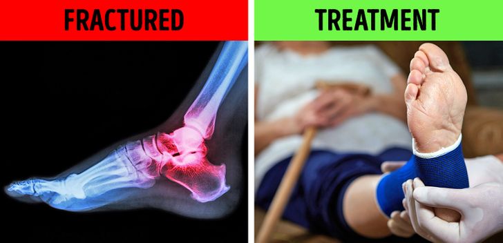 What to Do If Your Heel Hurts in the Morning or Every Time You Stand Up