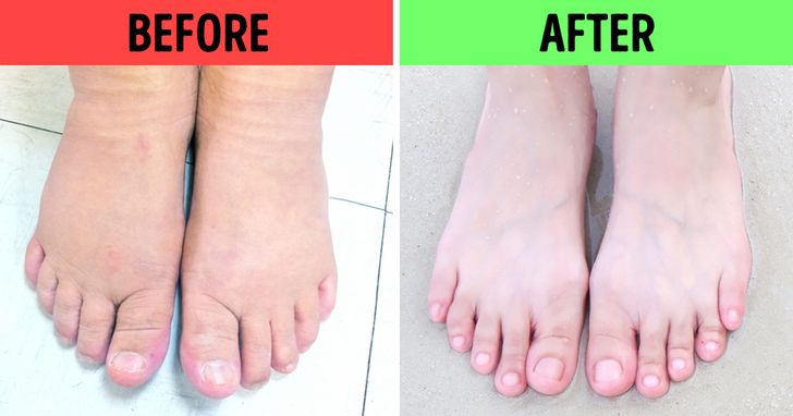 6 Types of Foot Baths and Which Health Problems They Can Solve