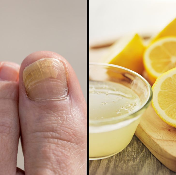 6 Types of Foot Baths and Which Health Problems They Can Solve