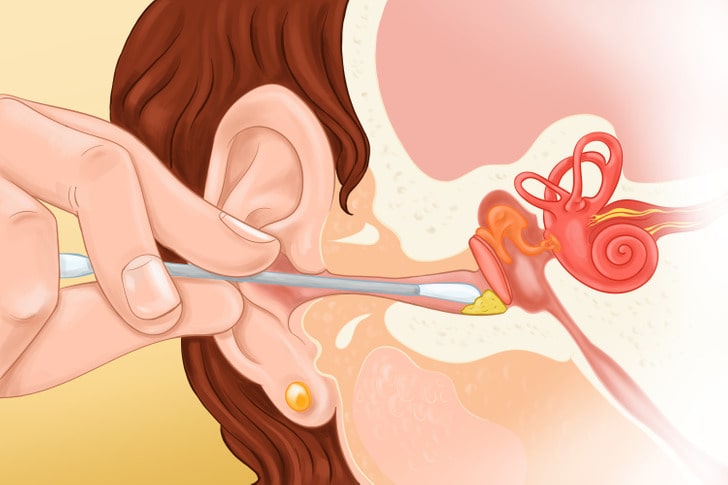 Why You Should Stop Cleaning Your Ears With Cotton Swabs And What to Do Instead