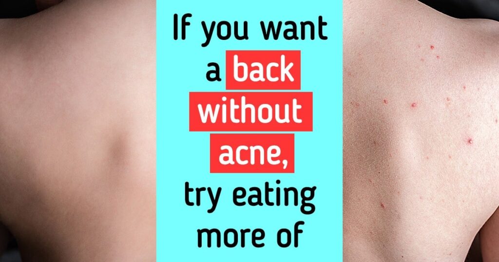 6-tips-to-get-rid-of-body-acne-and-bring-back-your-confidence-healthw